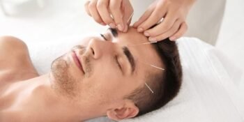 ACUPUNTURA